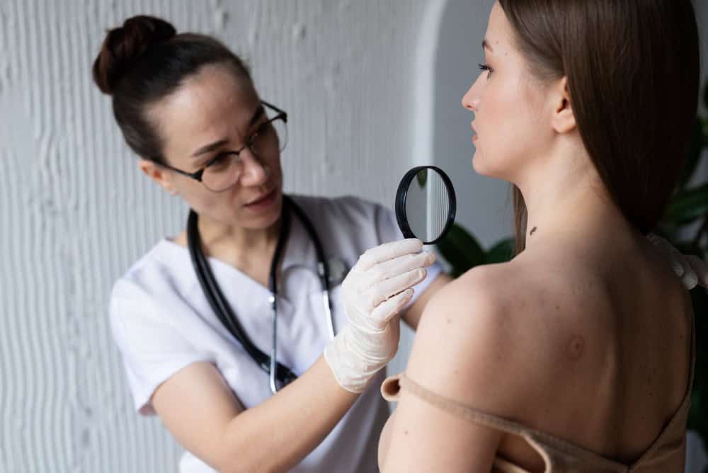 photo of a doctor checking a patient who has concerns about pimple scar treatment in hyderabad